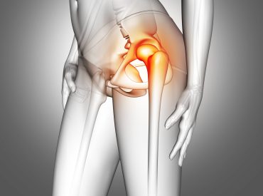 3D female medical figure with hip bone highlighted avn ayurvedic neuro